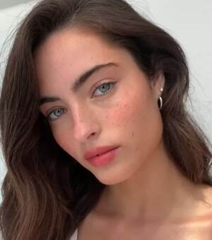 Some freckles