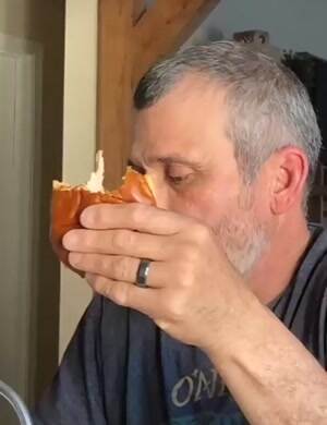 Why does your bite look like that