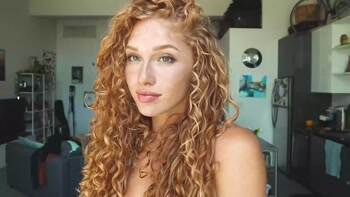 What amazing freckles